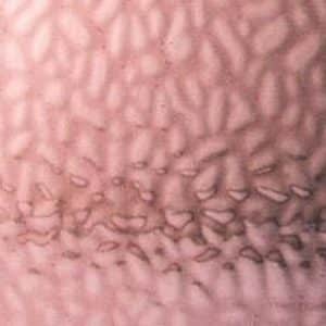 English Muffle - Scottish Heather